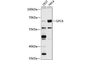 Western blot analysis of extracts of various cell lines, using GPC6 antibody (ABIN1680073, ABIN1680074, ABIN5664142 and ABIN6219786) at 1:1000 dilution.