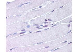 Anti-NUR77 antibody IHC of human skeletal muscle. (NR4A1 antibody  (AA 251-266))