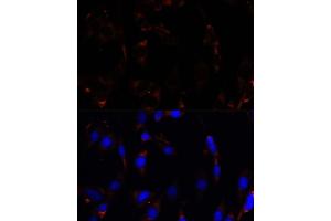 Immunofluorescence analysis of C6 cells using RPL26 antibody (ABIN7269999) at dilution of 1:100. (RPL26 antibody  (AA 20-95))