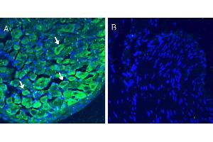 Immunohistochemical staining of frozen rat dorsal root ganglion (DRG) sections with Anti-Calcitonin Receptor-Like Receptor/CLR (extracellular) Antibody (ABIN7042979), (1:200), followed by goat anti-rabbit-.