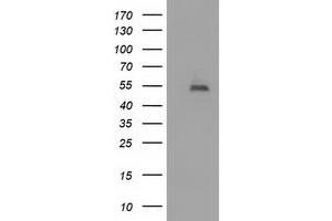 HEK293T cells were transfected with the pCMV6-ENTRY control (Left lane) or pCMV6-ENTRY HDAC1 (Right lane) cDNA for 48 hrs and lysed. (HDAC1 antibody)