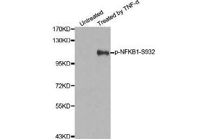 Western blot analysis of extracts from 293 cells untreated or treated with TNF-a using Phospho-NFKB1-S932 antibody. (NFKB1 antibody  (pSer932))