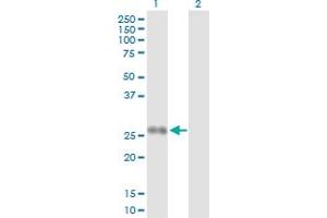 Western Blot analysis of PPP2R3B expression in transfected 293T cell line by PPP2R3B MaxPab polyclonal antibody. (PPP2R3B antibody  (AA 1-176))