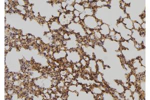 ABIN6275055 at 1/100 staining Mouse lung tissue by IHC-P. (DHRS4 antibody  (C-Term))