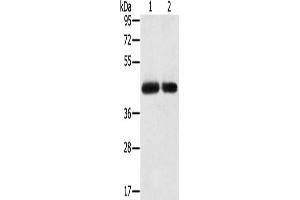 Gel: 8 % SDS-PAGE, Lysate: 40 μg, Lane 1-2: PC3 cells, hepg2 cells, Primary antibody: ABIN7192401(SLC16A3 Antibody) at dilution 1/200, Secondary antibody: Goat anti rabbit IgG at 1/8000 dilution, Exposure time: 2 minutes (SLC16A3 antibody)