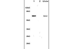 Formalin-fixed and paraffin embedded rat colitis labeled with Anti-IL-1R1/CD121a/IL1 Receptor I Polyclonal Antibody, Unconjugated (ABIN747743) at 1:200 followed by conjugation to the secondary antibody and DAB staining. (IL1R1 antibody  (AA 481-569))