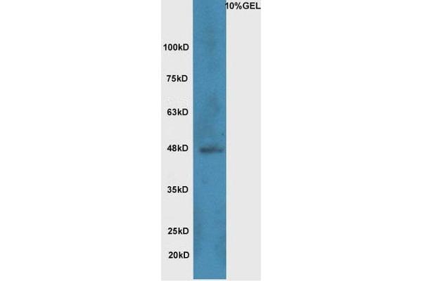 WNT8B antibody  (AA 131-230)