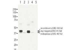 Image no. 1 for anti-Ribonucleotide Reductase M2 B (TP53 Inducible) (RRM2B) (N-Term) antibody (ABIN401481) (RRM2B antibody  (N-Term))