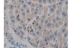Detection of HPSE in Rat Liver Tissue using Polyclonal Antibody to Heparanase (HPSE) (HPSE antibody  (AA 40-188))