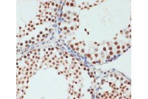 Immunohistochemistry of paraffin-embedded Rat testis using Phospho-POLR2A(S5) Polyclonal Antibody at dilution of 1:100 (40x lens). (POLR2A/RPB1 antibody  (pSer5))