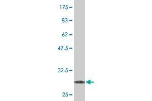 Western Blot detection against Immunogen (29. (SRD5A2 antibody  (AA 28-65))