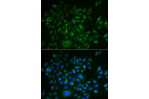 Immunofluorescence analysis of HeLa cell using BAMBI antibody.