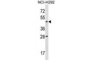 Western Blotting (WB) image for anti-Actin-Like 7b (Actl7b) antibody (ABIN2998793) (Actl7b antibody)