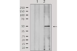 Western blot analysis of extracts from Hela, using FKRP Antibody.