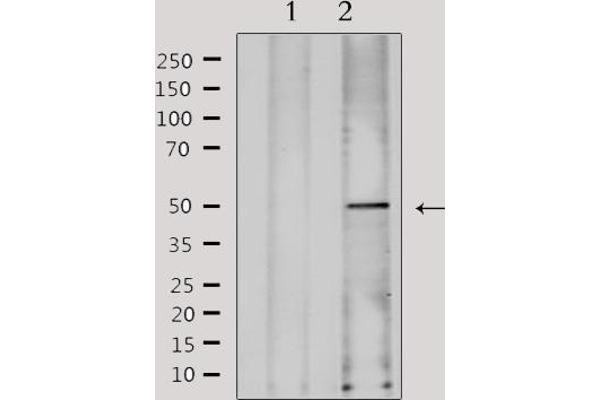 FKRP 抗体  (N-Term)