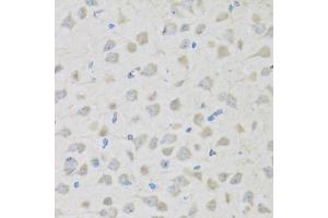 Immunohistochemistry of paraffin-embedded mouse brain using PENK antibody (ABIN6133151, ABIN6145444, ABIN6145445 and ABIN6221906) at dilution of 1:100 (40x lens). (Enkephalin antibody  (AA 25-267))