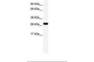 Image no. 2 for anti-Annexin A4 (ANXA4) (AA 31-80) antibody (ABIN202237) (Annexin IV antibody  (AA 31-80))
