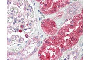 Immunohistochemistry (IHC) image for anti-Ectonucleoside Triphosphate diphosphohydrolase 5 (ENTPD5) (Center) antibody (ABIN2856876)