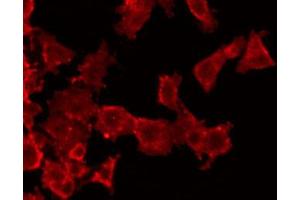 ABIN6272532 staining HuvEc by IF/ICC. (HNF1B antibody  (Internal Region))