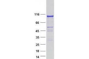 Validation with Western Blot