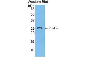 Western blot analysis of the recombinant protein. (FKBP8 antibody  (AA 110-329))