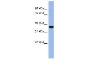 FANCL antibody used at 1 ug/ml to detect target protein. (FANCL antibody  (Middle Region))