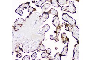 IHC analysis of PLAT using anti-PLAT antibody (ABIN6719378). (PLAT antibody)