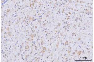 IHC analysis of RARS/RARS1 using anti-RARS/RARS1 antibody (ABIN7600223). (Probable Arginine--tRNA Ligase, Cytoplasmic (RARS-1) (AA 165-425) antibody)