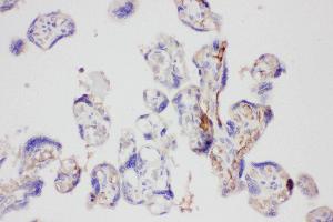 Anti-Galectin 3 Picoband antibody,  IHC(P): Human Placenta Tissue (Galectin 3 antibody  (AA 139-250))