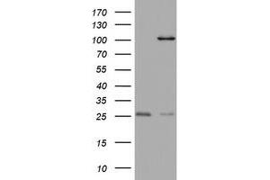 Western Blotting (WB) image for anti-Chromosome 3 Open Reading Frame 15 (C3orf15) (AA 1-313) antibody (ABIN2715591) (C3orf15 antibody  (AA 1-313))