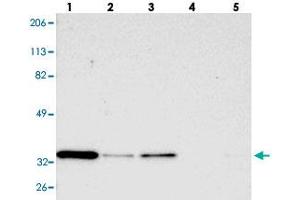 Western blot analysis of Lane 1: RT-4, Lane 2: U-251 MG, Lane 3: A-431, Lane 4: Liver, Lane 5: Tonsil with STX3 polyclonal antibody  at 1:250-1:500 dilution.