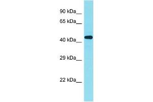 Host: Rabbit Target Name: ZNF506 Sample Type: Fetal Kidney lysates Antibody Dilution: 1. (ZNF506 antibody  (C-Term))