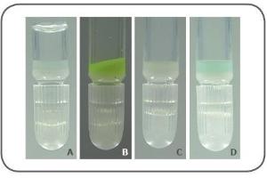 Image no. 1 for Ni-NTA Agarose (ABIN3199239)