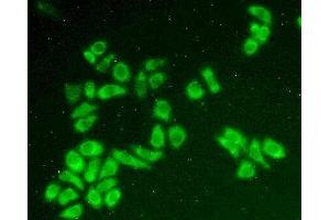 Detection of BLVRB in Hela cells using Polyclonal Antibody to Biliverdin Reductase B (BLVRB) (BLVRB antibody  (AA 2-206))