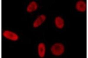 ABIN6275605 staining LOVO by IF/ICC. (SRSF11 antibody  (C-Term))