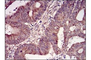 Immunohistochemistry (IHC) image for anti-Casein Kinase 2, beta (CSNK2B) (AA 1-215) antibody (ABIN5542448)