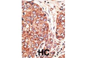 Immunohistochemistry (IHC) image for anti-Septin 9 (SEPT9) antibody (ABIN3002552)