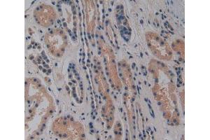 Used in DAB staining on fromalin fixed paraffin-embedded Heart tissue (NOSIP antibody  (AA 62-295))