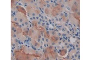 Figure. (LPCAT1 antibody  (AA 301-514))