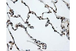 Image no. 11 for anti-Amyloid beta (A4) Precursor Protein (APP) antibody (ABIN1496877) (APP antibody)