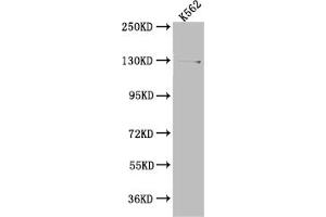 Western Blotting (WB) image for anti-Ubiquitin Specific Peptidase 7 (Herpes Virus-Associated) (USP7) antibody (ABIN7127535)