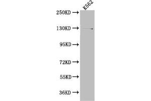Western Blot Positive WB detected in: K562 whole cell lysate All lanes: HAUSP antibody at 1:1000 Secondary Goat polyclonal to rabbit IgG at 1/50000 dilution Predicted band size: 129, 127 kDa Observed band size: 140 kDa (Recombinant USP7 antibody)