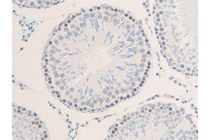 ABIN6267285 at 1/100 staining rat testicular tissue sections by IHC-P.