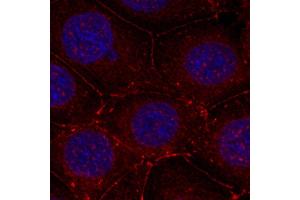 Immunofluorescence staining of methanol-fixed MCF-7 cells using Phospho-IGF1R-Y1161 antibody (ABIN2988064). (IGF1R antibody  (pTyr1161))