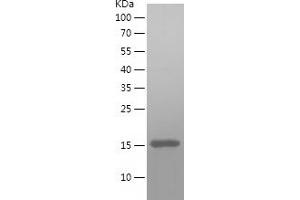 Western Blotting (WB) image for Mitochondrial Import Receptor Subunit TOM20 homolog (TOMM20) (AA 23-145) protein (His tag) (ABIN7123977) (TOMM20 Protein (AA 23-145) (His tag))