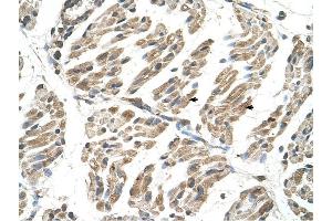 SLC6A8 antibody was used for immunohistochemistry at a concentration of 4-8 ug/ml to stain Skeletal muscle cells (arrows) in Human Muscle. (SLC6A8 antibody)