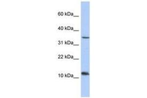 Image no. 1 for anti-Nucleoredoxin-Like 2 (NXNL2) (AA 71-101) antibody (ABIN6743672) (NXNL2 antibody  (AA 71-101))