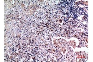 Immunohistochemistry (IHC) analysis of paraffin-embedded Human Lung, antibody was diluted at 1:100. (IL-6 antibody  (Internal Region))