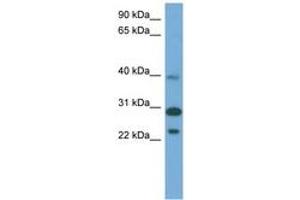 CCDC28A Antikörper  (AA 179-228)