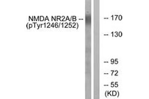 Western Blotting (WB) image for anti-Glutamate Receptor, Ionotropic, N-Methyl D-Aspartate 2A/B (GRIN2A/B) (AA 1216-1265), (pTyr1246) antibody (ABIN1531617) (NMDAR2A + 2B antibody  (pTyr1246))